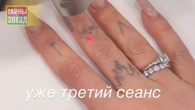 Ивлеева сводит татуировки